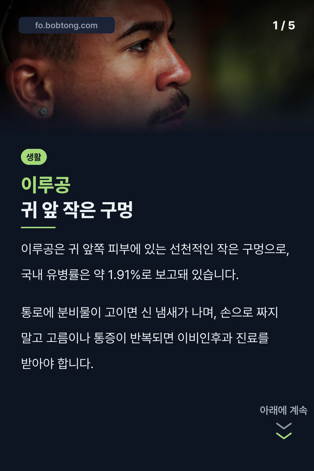 이루공 귀 앞 작은 구멍